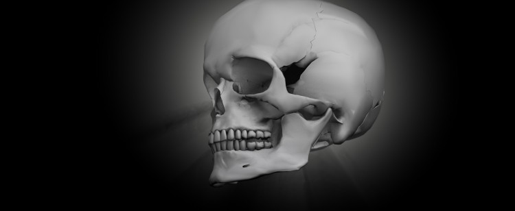 Disfunción de la articulación témporo-mandibular.
