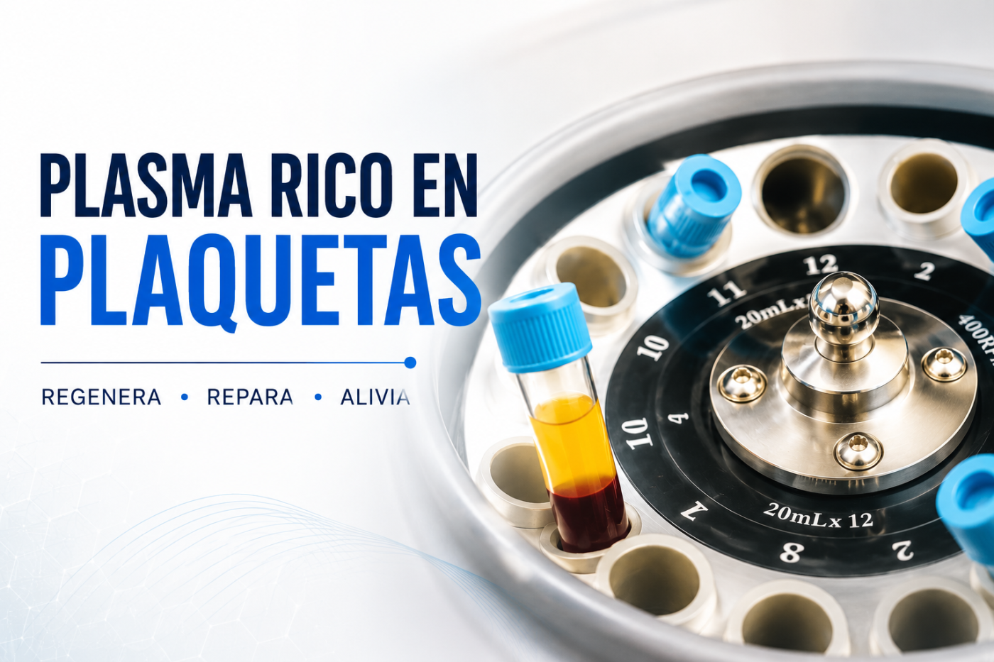 Medicina Regenerativa: ¿qué es el Plasma Rico en Plaquetas (PRP)?
