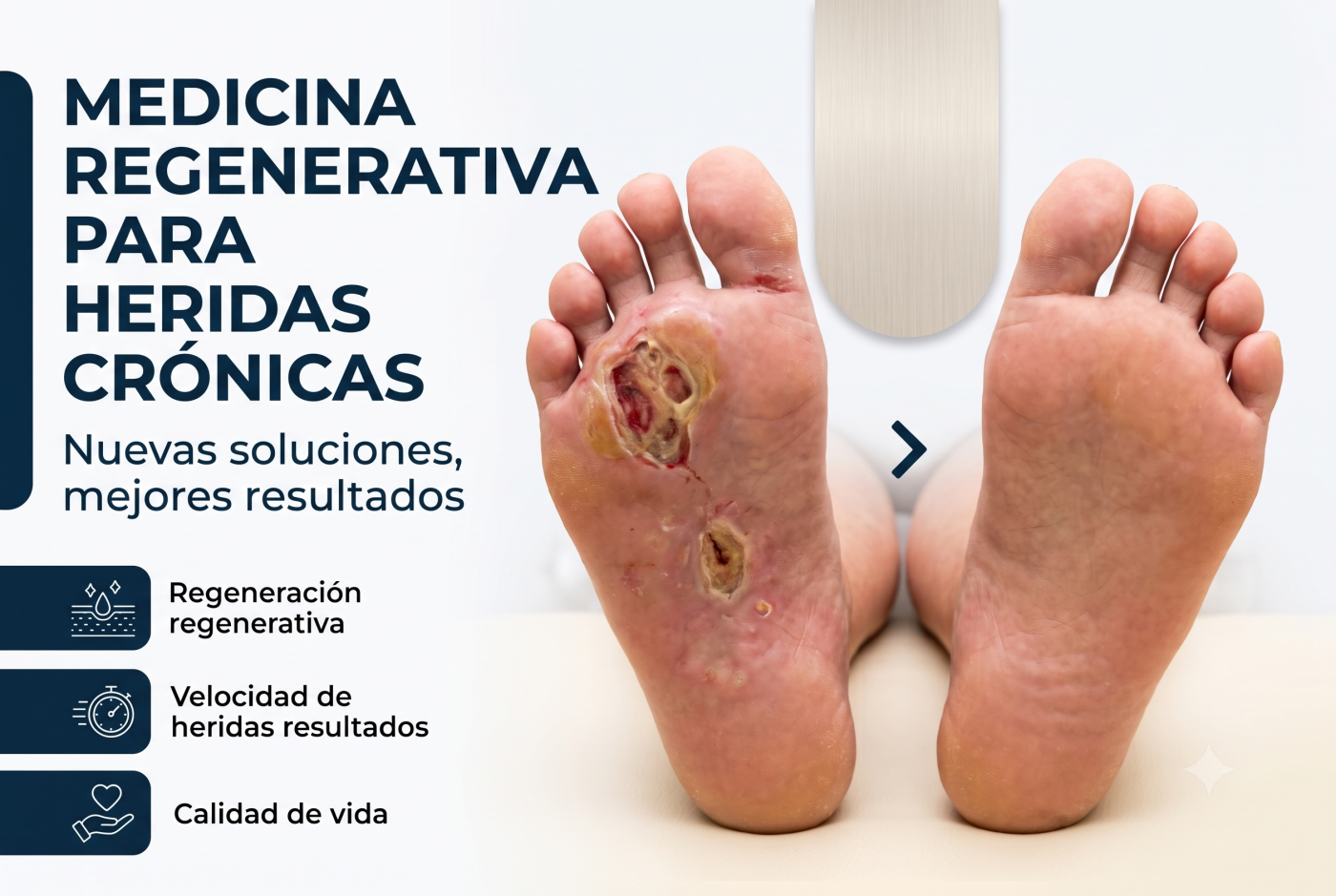 Medicina Regenerativa para heridas crónicas